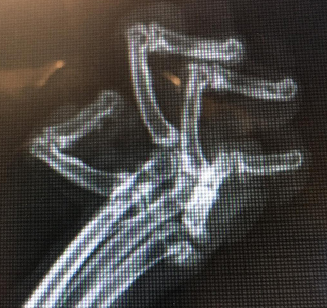 X-ray image of twisted digits on a cat's paw